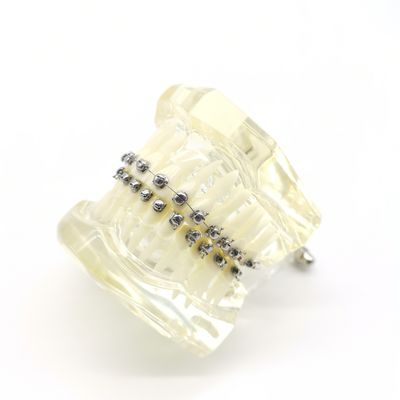 1st 2nd Bondable Single Molar Orthodontic Buccal Tube Metal Non Convertible