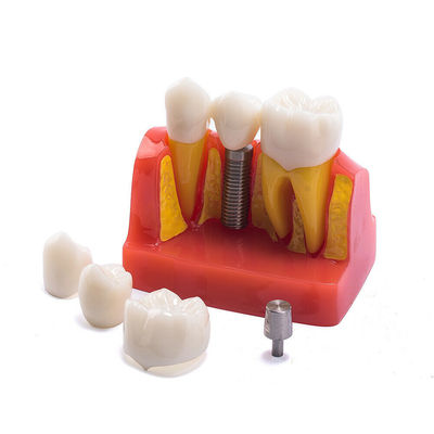 Class III Instrument Classification Dental Study Model for Dental Practice and Demonstration
