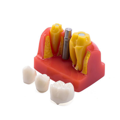 Class III Instrument Classification Dental Study Model for Dental Practice and Demonstration