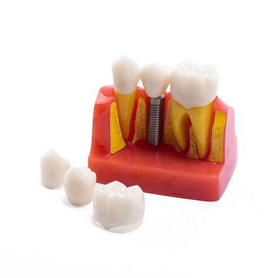 Class III Instrument Classification Dental Study Model for Dental Practice and Demonstration
