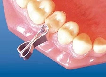 Class II Dental Kit of Metal Matrices for molars Combined with Clamp Universal Kit TOR VM/ TOP BM PROFESSIONAL DENTAL