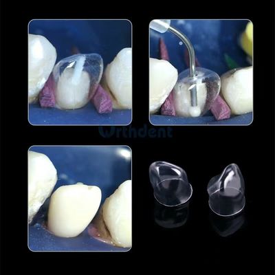 64pcs Dental Crown Matrices Posterior Clear Transparent Strip Matrix 1.911/1.910/1.912/1.915 by TOR VM Certification CCC