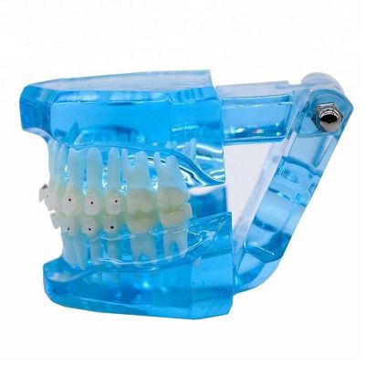 Orthodontic Teeth Development Model CE Certified ALS Dental Teaching Models with Brackets