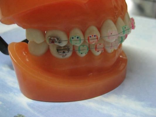 Orthodontic Teeth Development Model CE Certified ALS Dental Teaching Models with Brackets