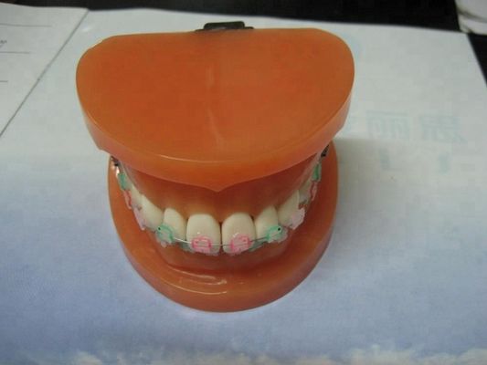 Orthodontic Teeth Development Model CE Certified ALS Dental Teaching Models with Brackets