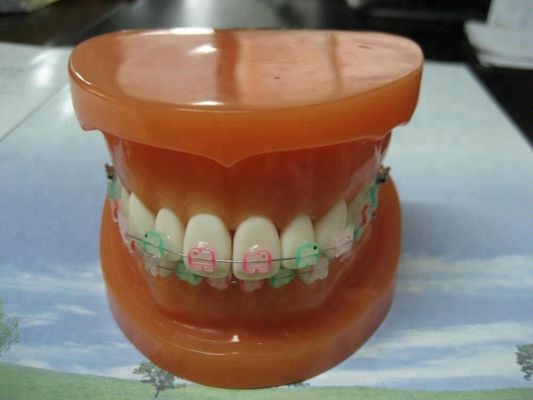 Orthodontic Teeth Development Model CE Certified ALS Dental Teaching Models with Brackets
