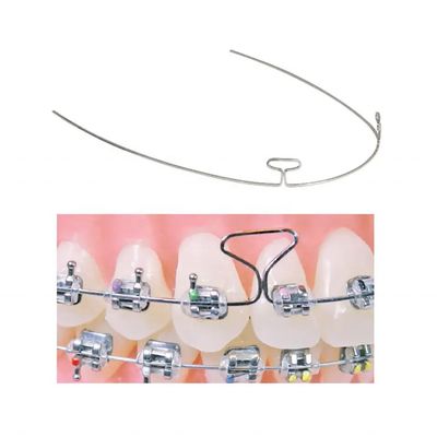Orthodontic Stainless Steel Bull Braces Loop Wire For Teeth Alignment And Dental Retention