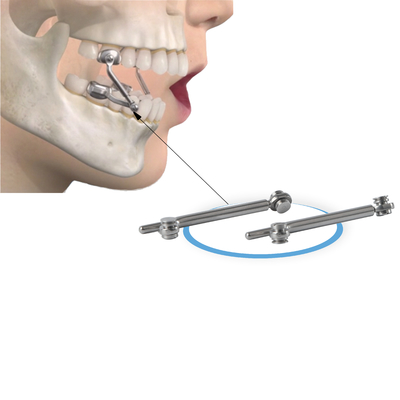 Herbst Appliance Jaw Corrector 18-31mm Stainless Steel Orthodontic