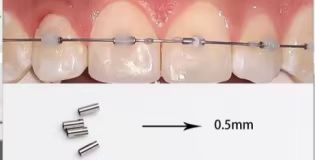 Crimpable MINI Stops Large 0.8mm Small 0.5mm 10 pcs/pk