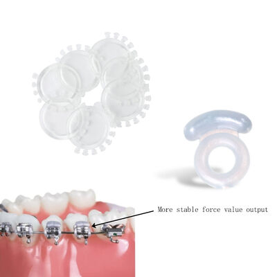 Clear Grey Ligature Tie with Anti-Slip Guard for Secure Archwire Stabilization Using Latex-Free Elastomers