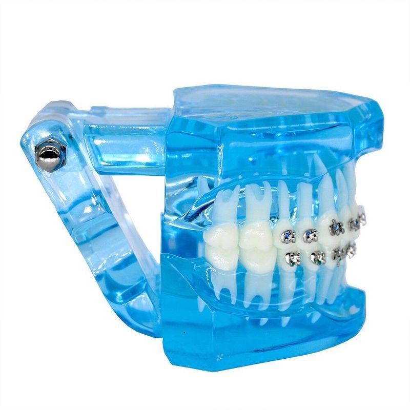 Orthodontic Teeth Development Model CE Certified ALS Dental Teaching Models with Brackets